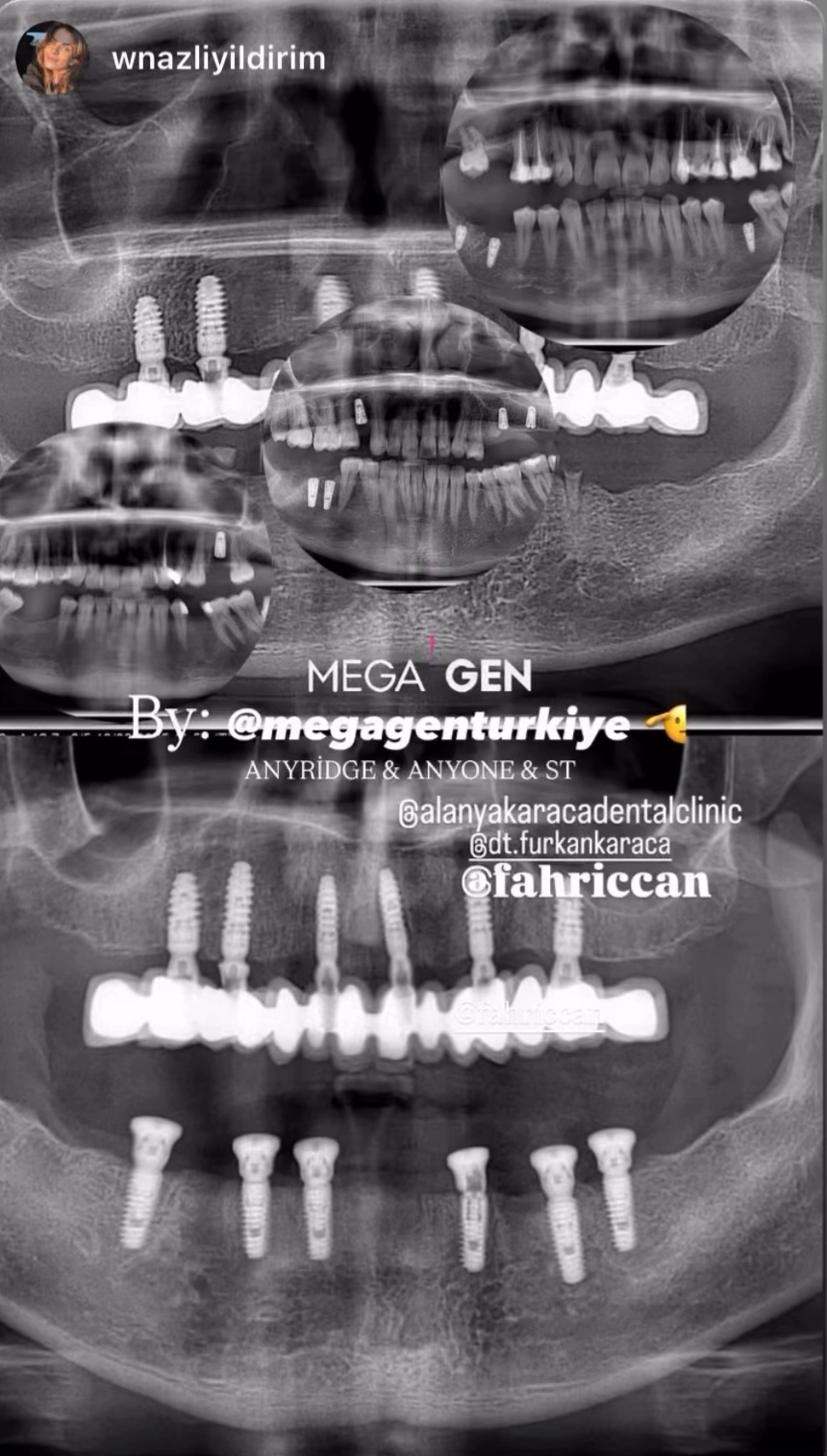 Alanyada Diş Kliniği | KARACA DENTAL CLINIC