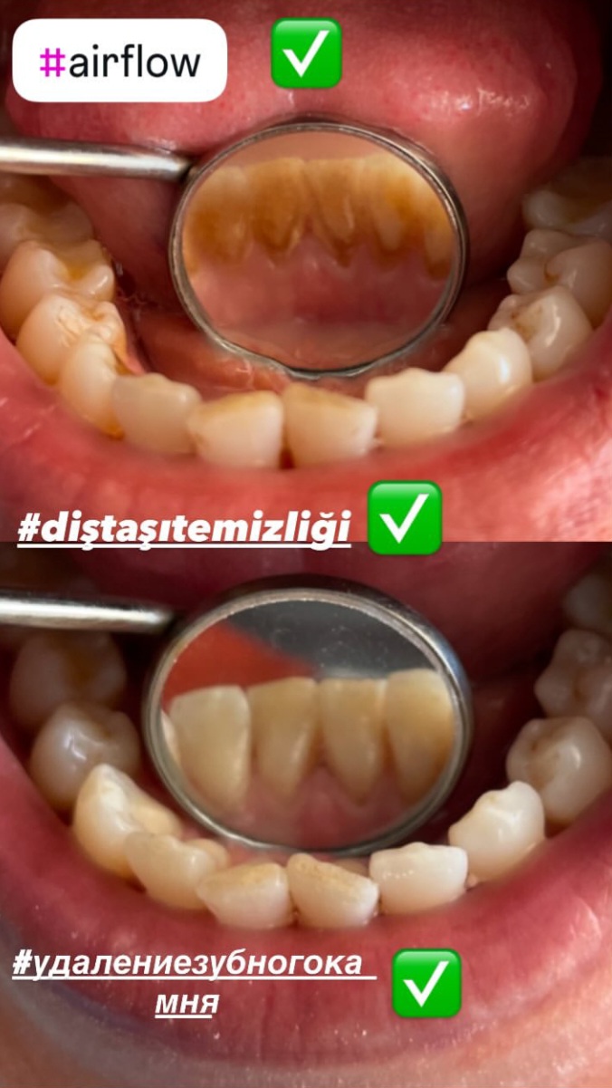 Alanyada Diş Kliniği | KARACA DENTAL CLINIC