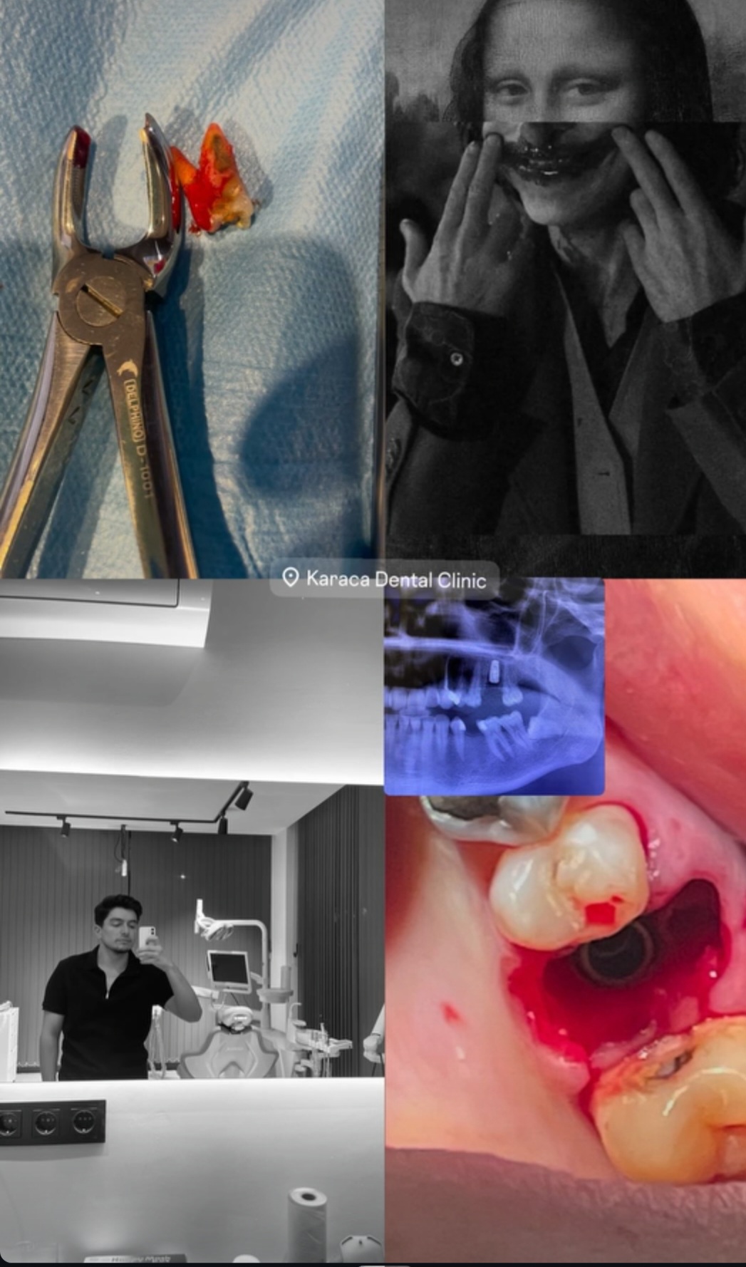 Alanyada Diş Kliniği | KARACA DENTAL CLINIC
