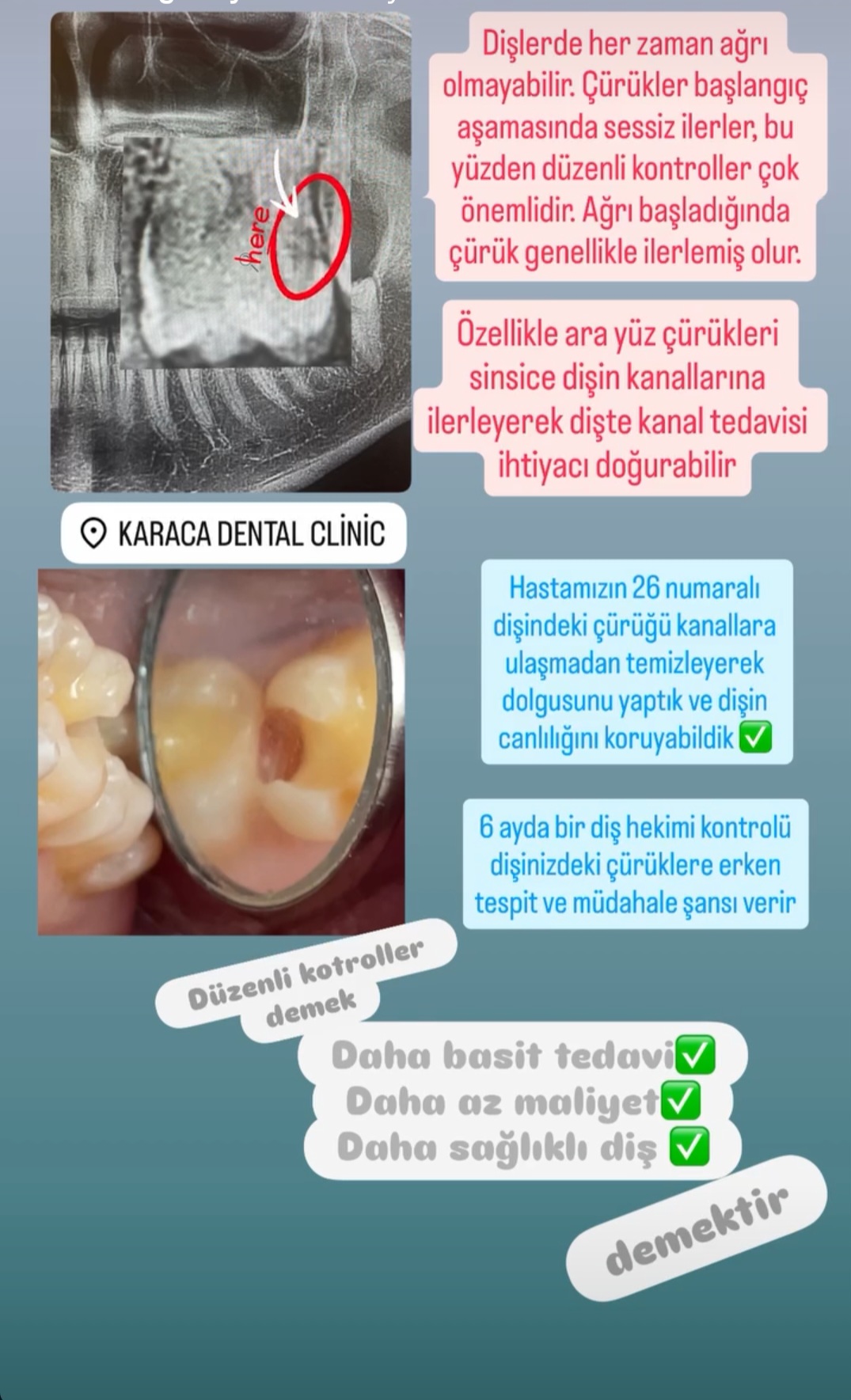 Alanyada Diş Kliniği | KARACA DENTAL CLINIC